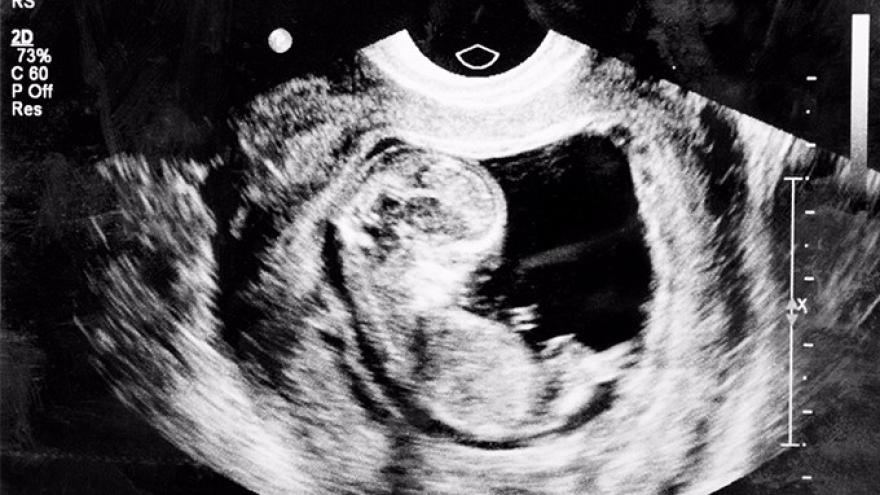 流产不全不清宫会怎样