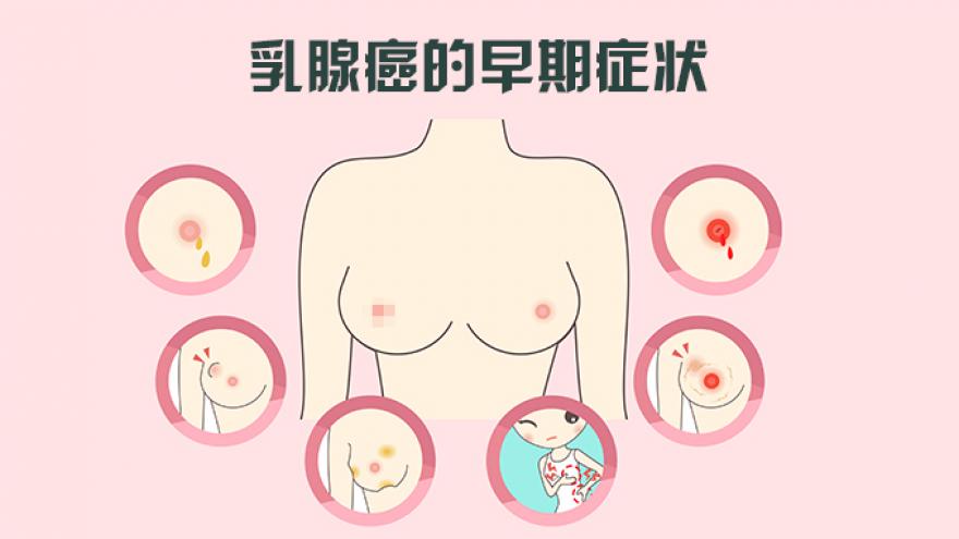 乳腺癌的早期症状有哪些