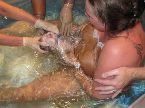 水下分娩是一种什么体验：所有孕妇都能水下分娩吗