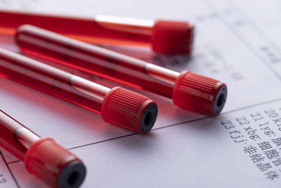 血hcg太早验没有意义 那血hcg应该什么时候验才准确