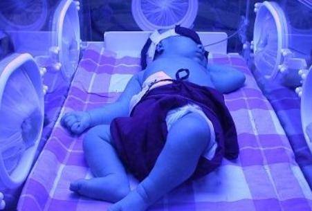 如何区分宝宝的黄疸是生理性还是病理性 新生儿黄疸怎么办?