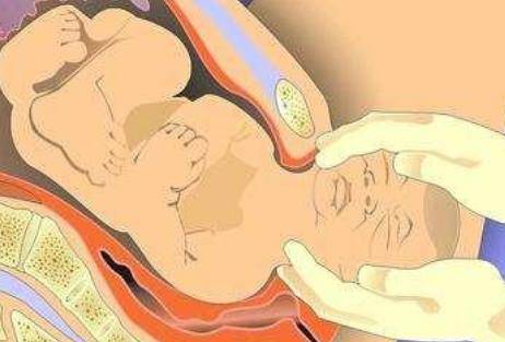 产后恢复:宝妈把握黄金42天,不让大肚子放任自流