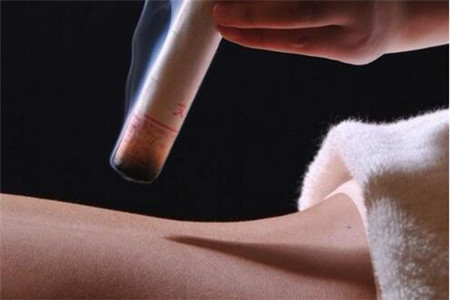 详解艾灸的功效与作用和禁忌