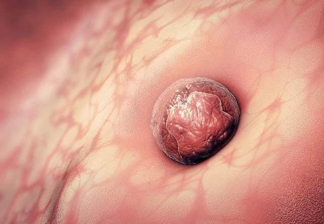 怀孕刚着床的6个反应 怀孕刚着床的6个反应