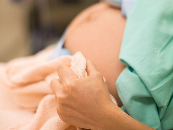 无痛分娩需要预约吗 无痛分娩的注意事项