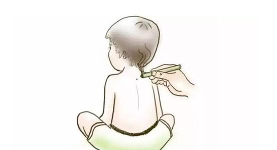 宝宝发烧艾灸哪个部位