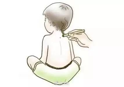 宝宝发烧艾灸哪个部位