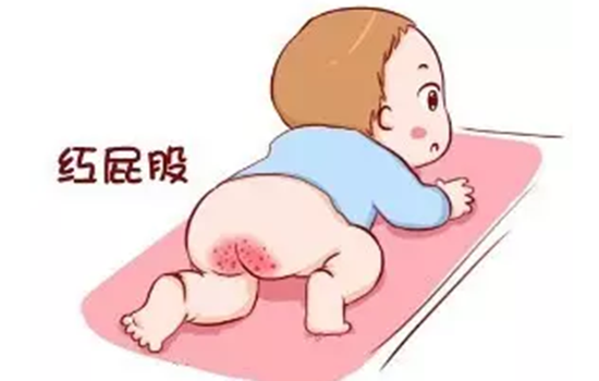 宝宝红屁股的原因 妈妈应警惕这五点