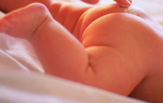 无比滴可以涂红屁股吗