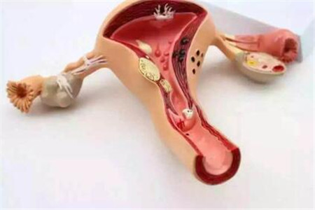 宫颈糜烂,到底是不是一种疾病?