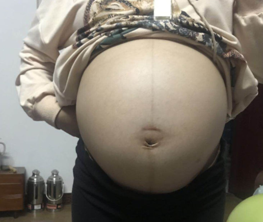 早孕出现这一信号,也暗示着先兆流产,别不当回事