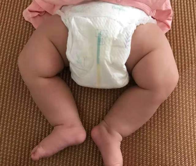 宝宝一到冬天就＂红屁屁＂？宝妈学会这3招,宝宝少遭罪