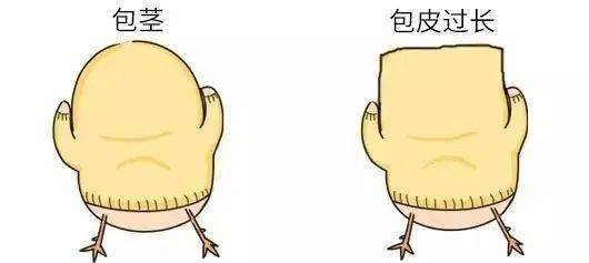 孩子包皮有点长,要不要割？