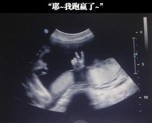 产检做得好B超少不了,5~10周B超主要查什么？准妈妈要知道