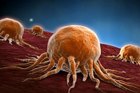 尖锐湿犹早期什么状况？这三个尖锐湿犹的症状