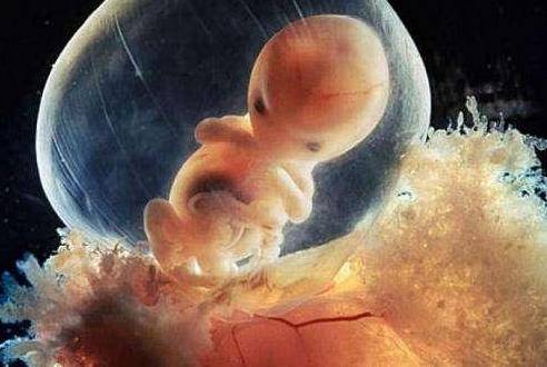 出现胎停育的原因有哪些？原来有这些征兆！
