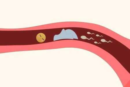 女人输卵管堵塞的两大常见原因