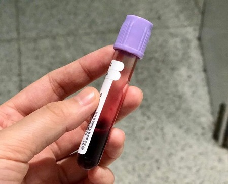 孕早期判断胎儿发育得好不好,看5个B超指标3个表现,孕妈收藏