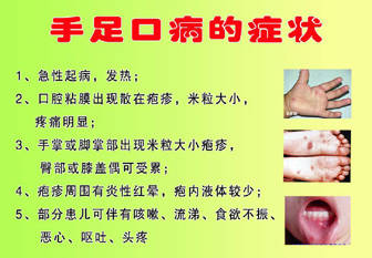 宝宝手足口病症状图 儿童手足口病初期症状图片