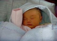 【病理性黄疸】什么是病理性黄疸_病理性黄疸的原因