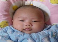 【白色胎记】白色胎记的危害_白色胎记的治疗