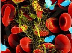 【新生儿溶血症】什么是新生儿溶血症_新生儿溶血症的症状