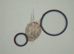 【螨虫】被螨虫咬的症状_螨虫怎么去除