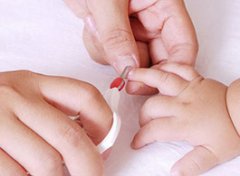 【倒刺】倒刺是什么_倒刺怎么办