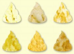 【婴儿大便颜色】婴儿大便正常颜色_婴儿大便颜色异常怎么办