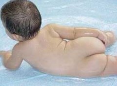 【小儿过敏性皮炎】小儿过敏性皮炎症状有哪些_小儿过敏性皮炎治疗方法