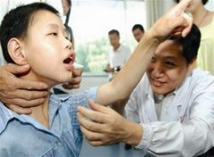 【小儿癫痫】小儿癫痫能治好吗_小儿颠痫病的早期症状