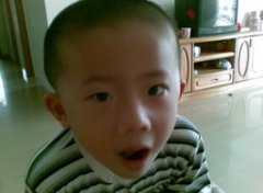 【斜视】斜视怎么矫正_斜视的症状