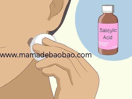 如何去除脸上的痣sugardvd（观察你的痣）