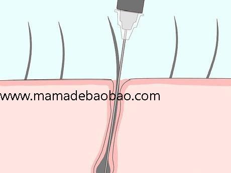 5种方法来去除腋毛（剃毛）