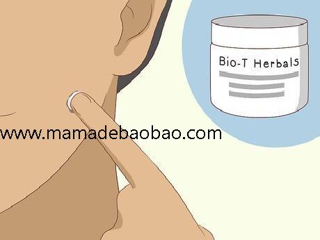 如何去除脸上的痣sugardvd（观察你的痣）