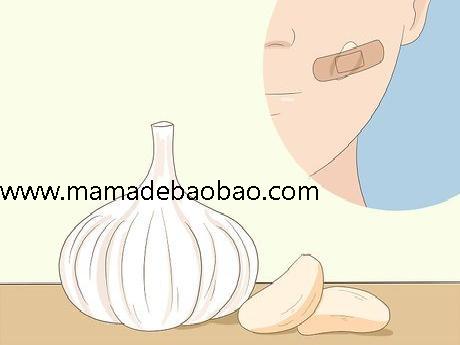 如何去除脸上的痣sugardvd（观察你的痣）