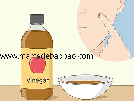 如何去除脸上的痣sugardvd（观察你的痣）