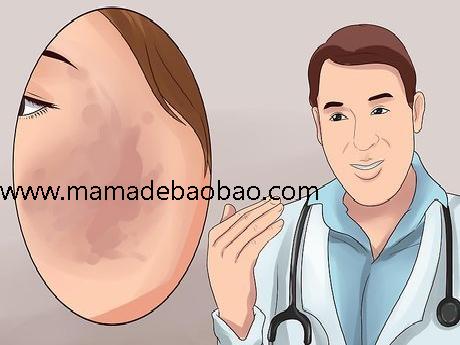 如何去除脸上的黑斑（找出诱因）