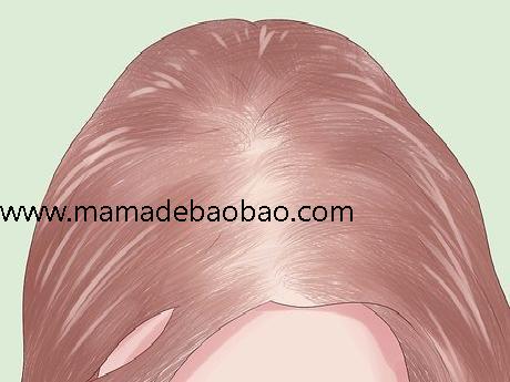 如何防止压力太大造成脱发(了解压力性脱发)