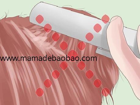 如何防止压力太大造成脱发(了解压力性脱发)