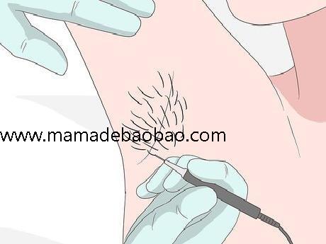 5种方法来去除腋毛（剃毛）