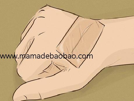 如何去除疤痕疙瘩: 9 步骤（天然疗法）