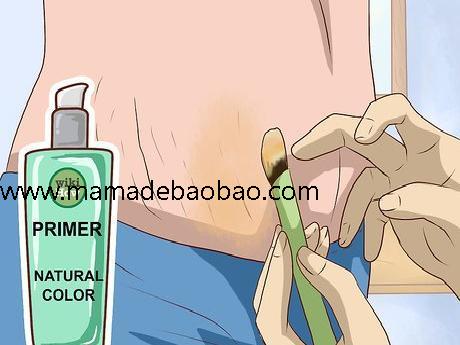 4种方法来在家里消除妊娠纹（维生素C疗法）