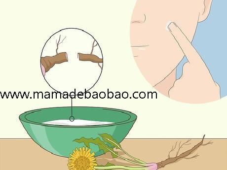 如何去除脸上的痣sugardvd（观察你的痣）