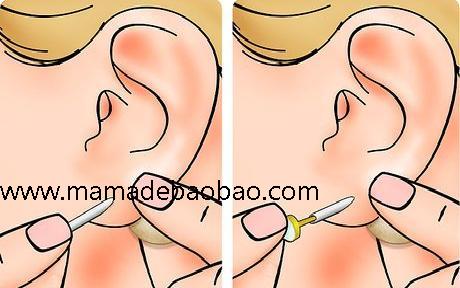 3种方法来自己穿耳洞（做好穿耳的准备）